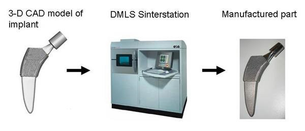 帶數百個小爪的新3D打印骨植入物使用壽命更長